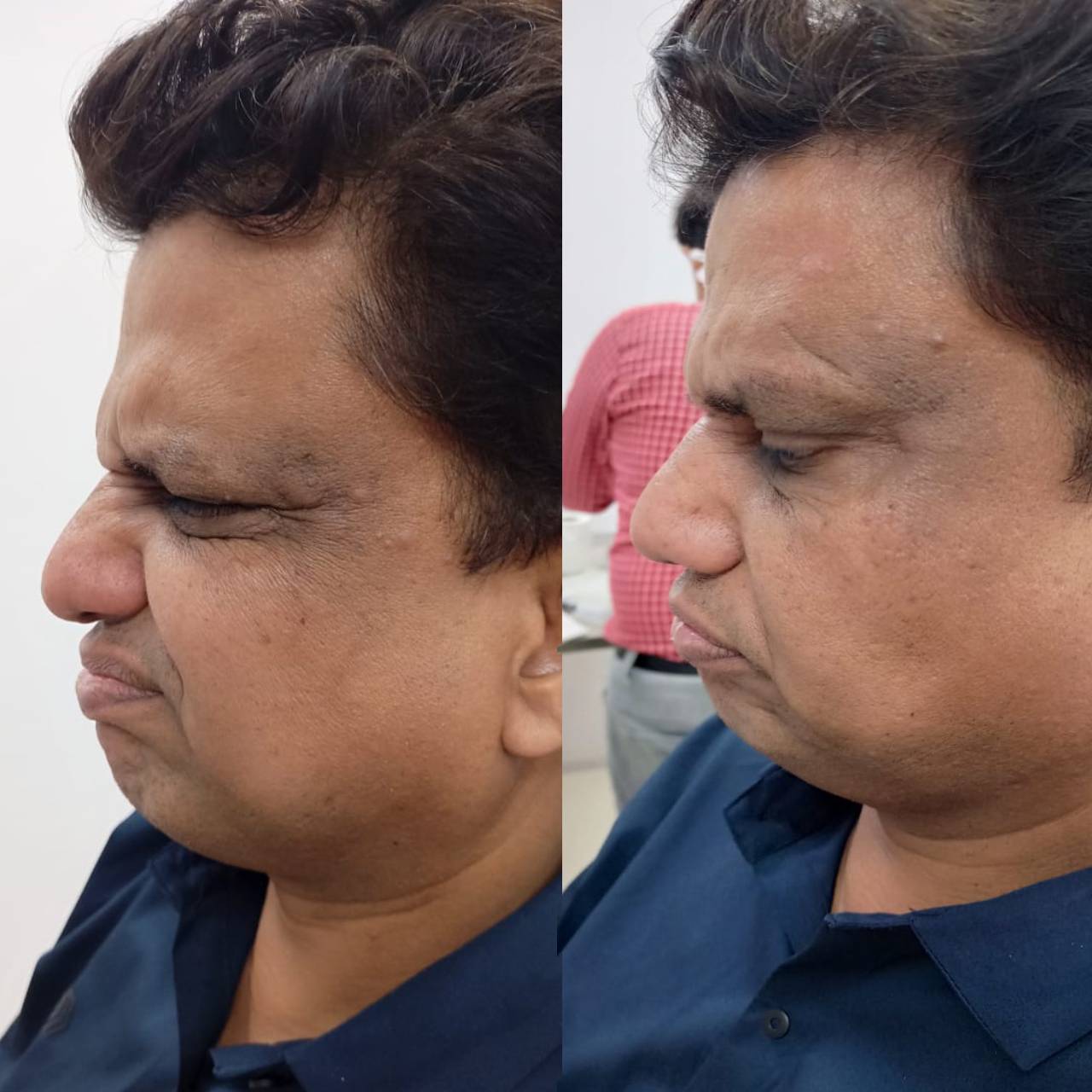 Skin Treatment in Udaipur